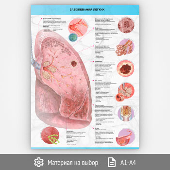 ������ ������������ ������� (�-30, 1 ����)