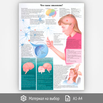 Плакат «Что такое эпилепсия?» (ЗОЖ-23, 1 лист)