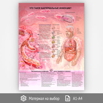 Плакат «Что такое бактериальные инфекции?» (ЗОЖ-39, 1 лист)